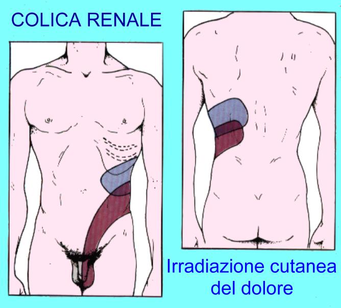 Il prurito di dorso passa da un fegato